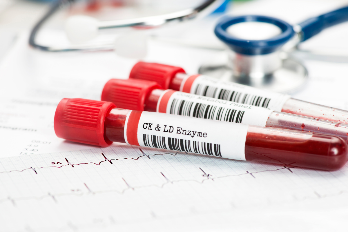 trois fioles remplies de sang pour les analyses sanguines