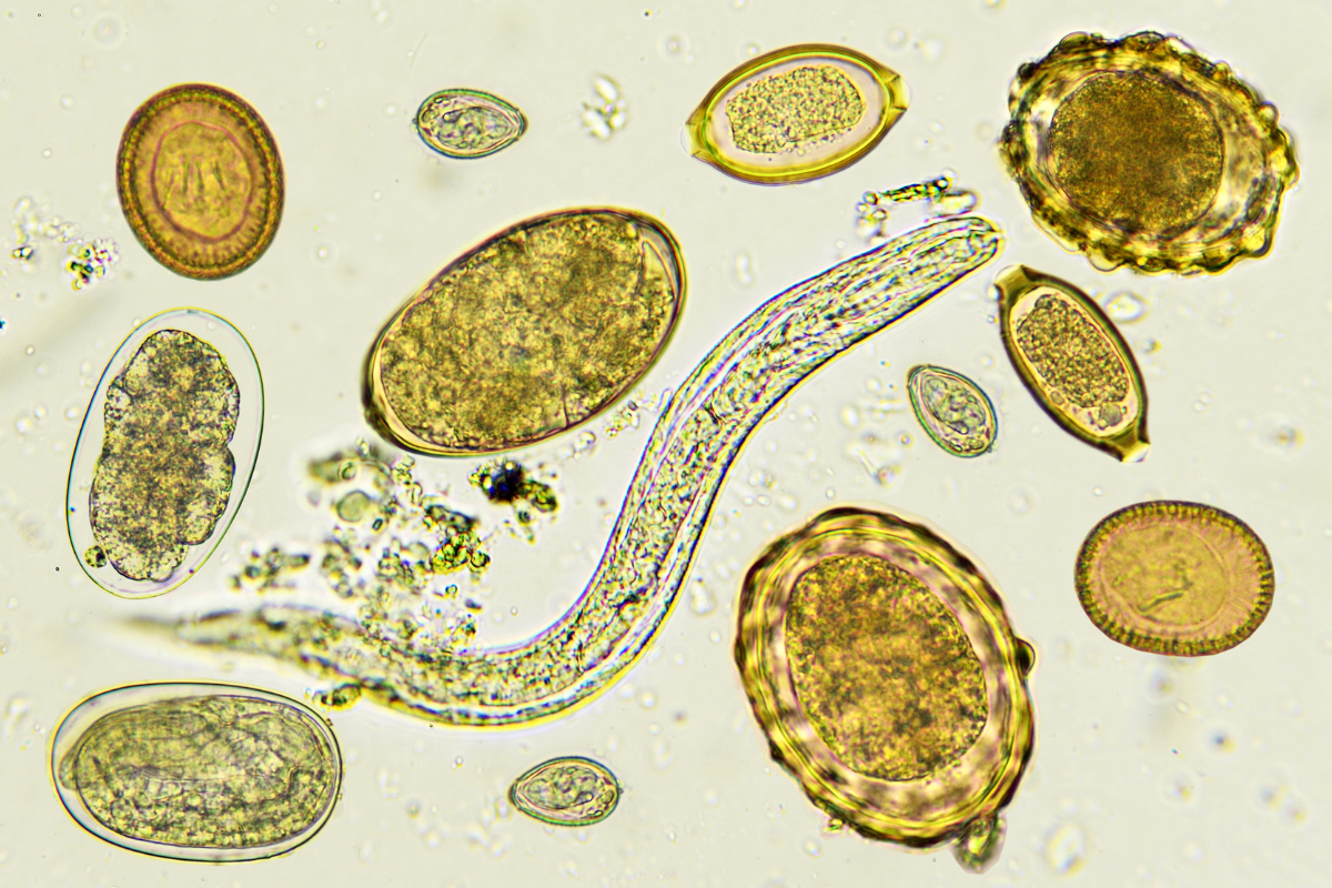 vue au microscope d'un vers et de parasites